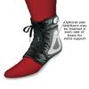 Swede-O Ankle Lok Ankle Brace, White - XSmall view 2