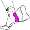 Atlas Biomechanics Achilles Heel Protection Elastic Gel Pad Sock (Pair) from, for Haglund's (Pump Bump) (Large/X-Large) view 2