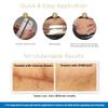 Embrace Active Scar Defense for New Scars, FDA-Cleared Medical-Grade Silicone Scar Sheets for Hypertrophic & Keloid Scar Treatment, 4.7 Inch, Large, 30-Day Supply view 3
