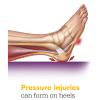 Sage Stryker Prevalon Heel Protector III  1 Heel Protector  Cushioned Boot for Heel Pressure Relief with Stabilizing Wedge for Bed-Bound Individuals  Standard Size view 4