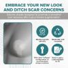 EpiDerm Areopexy Silicone Scar Sheets - Reusable, Washable & Customizable - Lollipop Shape Ideal for Lejour Breast Augmentation - Premium-Grade Silicone for Optimal Scar Management  Clear, 5 Pairs view 2