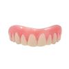 Instant Smile Upper Veneer view 1