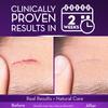 Cicatricure Advanced Scar Gel for Face & Body - Proven Results in 2 Weeks, Scar Treatment for Surgical Scars, Stretch Marks, Scars of Burns and Injuries, Acne Scar Treatment, 1 oz (28 g) view 3