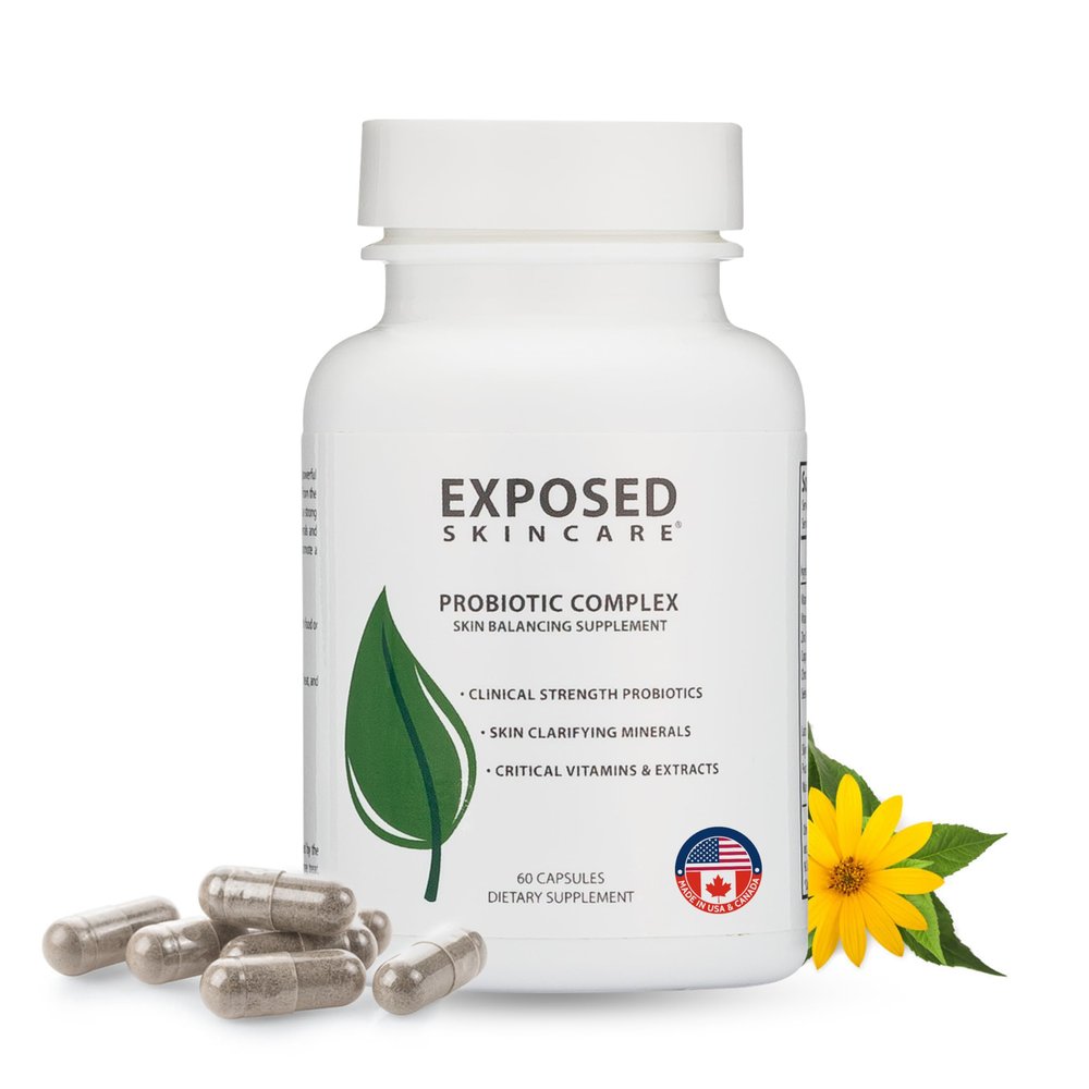 Exposed Skin Care, Probiotic Supplement Complex with 1 Billion CFU Daily Probiotic for Skin, Gut and Immune Health Support Digestive Wellness Formula for Men and Women Non-GMO, 60 Capsules