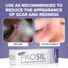 Pro-SIL Kids 4.25g  Mess-Free, Glide-On Silicone Stick for Kids  Hypoallergenic, Non-Toxic Silicone Formula  Pocket-Sized Scar Treatment for On-The-Go Use  Ideal for Exposed Scars on Face & Body view 4