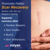 Rolyan Suction Pump, Assists with Lesion Healing, Tendon Repair, and Grafting, Extractor Suctions to Increase Skin Mobility, Various Suction Cup Sizes for Cupping view 2