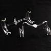 Airgoesin Dental Orthodontic Intraoral Mouth Cheek Lip Retractor Openers Bow Shape 4/pk view 3