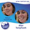 Temptooth #1 Seller Trusted Patented Temporary Tooth Replacement Product view 4
