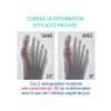 Epitact - Hallux Valgus (Bunion) Day Corrector - Size S view 4
