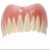 Instant Smile Teeth Upper Veneers (Small) view 1