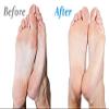 Emjoi Micro-Pedi 3D POWER Callus Remover with Xtreme Coarse Soft & Flexible Roller (Most Powerful & Corded) view 4
