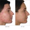 jane iredale Advanced Nutrition Programme Skin Accumax Supplement distributed by jane iredale, 60-day supply view 3
