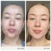 jane iredale Advanced Nutrition Programme Skin Accumax Supplement distributed by jane iredale, 60-day supply view 4