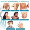 NewGel Plus by MyNewGel Advanced Silicone Scar Sheet Strips for C-Section, Abdomen, Surgical Scars, 2 x 8 Ultra Thick, with Adhesive Tape, CLEAR (2 Pack) view 4