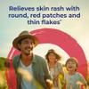 Boiron Berberis Vulgaris 3C for Skin Rash with Round, Red Patches & Thin Flakes - 80 Pellets view 2