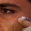 The Complete Guide to BOTOX Injections view 4