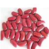 BULK Organic Red Kidney Bean, 1 LB view 1