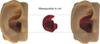 Doc's ProPlugs (pair) Clear, Vented - Small view 3