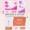 Wondfo Pregnancy Test Strip - Individually Wrapped HCG Strips - Highly Sensitive Home Detection Pregnancy Test Kit - Clear HCG Test Results - 20 Count-Expires 04/29/2026 view 2