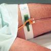 Special Pack of 5 Foley Catheter Holder Dale - Dale Medical 316 view 1