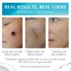 Advanced High-Potency Silicone Scar Gel with Vitamin E for Old, New Scars, Surgery, Keloids, Burns, and Facial Blemish Scars, NewGel Plus by MyNewGel (15 Grams) - 0.50 oz view 3