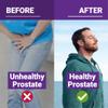 NEW ROOTS HERBAL Prostate Supplement with Super Blend of 16 Powerful Herbals: Saw Palmetto, Plant Sterols, Rye Flower, Borage Oil, Cranberry, Olive Oil, Selenium (30 Softgels) - Urinary Health view 4