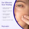 Rejuvaskin Scar Esthetique Scar Cream with Silicone, Reduces the Appearance of Surgical Scars, Burns, Stretch Marks, Keloids & Acne Scars, 10ml/0.338 Oz view 3