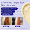 Rejuvaskin Scar Esthetique Silicone Scar Cream, Advanced Keloid & Surgical Scar Treatment, Fades Discoloration & Acne Scars with Onion Extract, Arnica & Vitamin C 60mL view 3