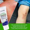 TriDerma Intense Fast Skin Healing Cream for Hard-to-Heal Skin Irritations, Sores, Rashes, Dry, Cracked Hands, Cuts, Chafing, Burns, Scrapes - First Aid Kit Essential - FSA Eligible - 2.2 oz view 3