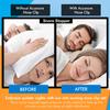 Acusnore Anti Snore Magnetic Nose Clip- Stop Snoring Device Comfortable Silicone with Travel Carry Case view 3
