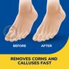 Dr. Scholl's Liquid Corn & Callus Remover, 0.33 Ounce // Removes Corns & Calluses Fast with Cushions That Provide Protection Against Shoe Pressure and Friction for All-Day Pain Relief view 4