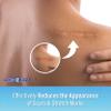 Scar Zone Advanced Scar Removal Cream - Scar Cream for Surgical Scars, Stretch Marks Removal, C Section & Fades Old & New (0.75 oz, Pack of 2) view 2