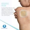 Dynarex DynaDerm Hydrocolloid Dressings, Sterile Moist Bandages, 2" x 2," Thin & Latex-Free, Peel-Down Patches, 1 Case - 12 Boxes of 20 DynaDerm Hydrocolloid Dressings (Packaging May Vary) view 4