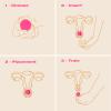 INTIMINA Laselle Exerciser 28g - Small Kegel Balls for Women - Bladder Control Kegel Weights view 4