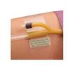 Hold-n-Place Foley Catheter Holder Adhesive Patch, One Size Fits All view 1