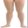 Scholl Softgrip Ultima Class 3 Open Toe Thigh Length Stockings, Medium, Natural view 1