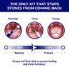 ORAVIX Tonsil Stone Remover - Tonsil Stone Removal Kit - Tonsillolith Remover Tool - Tonsil Cleaner - Fight Bad Breath - Tonsil Stone Removal Tool - Oral Irrigator - Tongue Scraper - 7 Pieces view 3