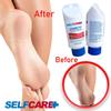 SelfCare+ Diabetic Foot Cream For Dry Cracked Feet. Leaves Hands Legs, Feet & Body Smooth Patented Lotion, 5 oz view 3