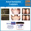 Dermasolve Psoriasis, Seborrheic Dermatitis and Dandruff Cream Formulated to Treat Itchy Skin & Prevent Future Flares to Provide Soothing Moisturizing Relief. (4.0 oz.) 5-Pack view 4