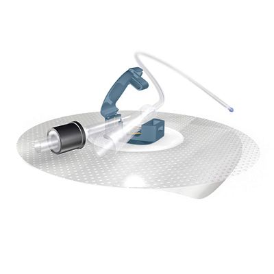 Ugo Fix Gentle (x5) Medical Urinary Catheter and Leg Bag External Securement Clip with Silicone Technology, Easily Adheres to Your Skin with no Preparation Needed (Pack of 5)
