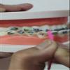 1/4" inch Orthodontic Elastic Rubber Bands 300 Pack Natural Medium Force 3.5 oz for making bows, Dreadlocks, Dreads, Doll Hair, Braids, Horse Mane Tail, tooth gap + FREE elastic placer by AdentalZ view 3