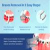 ARTMAN INSTRUMENTS Orthodontic Bracket Remover Pliers Curved  Braces Removal Tool for Back Teeth & Inner Brackets, Stainless Steel, Autoclavable view 2