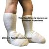 Bariatric Sock for Extreme Lymphedema Calf stretches to 30" (Black) view 4