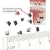 10 Pcs SmileTech New Bite Turbos Dental Orthodontic Materials view 2