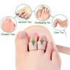 Welnove - Hammer Toes Straightener Toe Splint Corrector for Claw, Curled, Crooked Toe, Cushion Brace Joint Realign Metatarsal Support Loop Pack of 2 (2 Holes) view 3