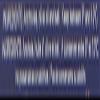 Arroyabe Anchovies in oil, 1.76-Ounce Cans (Pack of 5) view 3