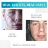 MyNewGel Advanced Silicone Scar Treatment Sheets | Old, New Scars, Surgery, Keloids, C-Section, Burns | 1" x 3" Sheet (3 Count) - Clear view 3