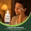 East Park Research - d-lenolate Olive Leaf Topical - All Natural Eczema Skin Formula Relieves Psoriasis, Rosacea, Dermatitis, and Rashes (4 oz) view 2