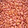 LIGHT RED KIDNEY BEANS- 22lb view 1