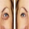 Besha Verisol Collagen Peptides Made in Germany 2-Month Supply Natural Flavor Skin, Hair, Nail & Joint Support view 3